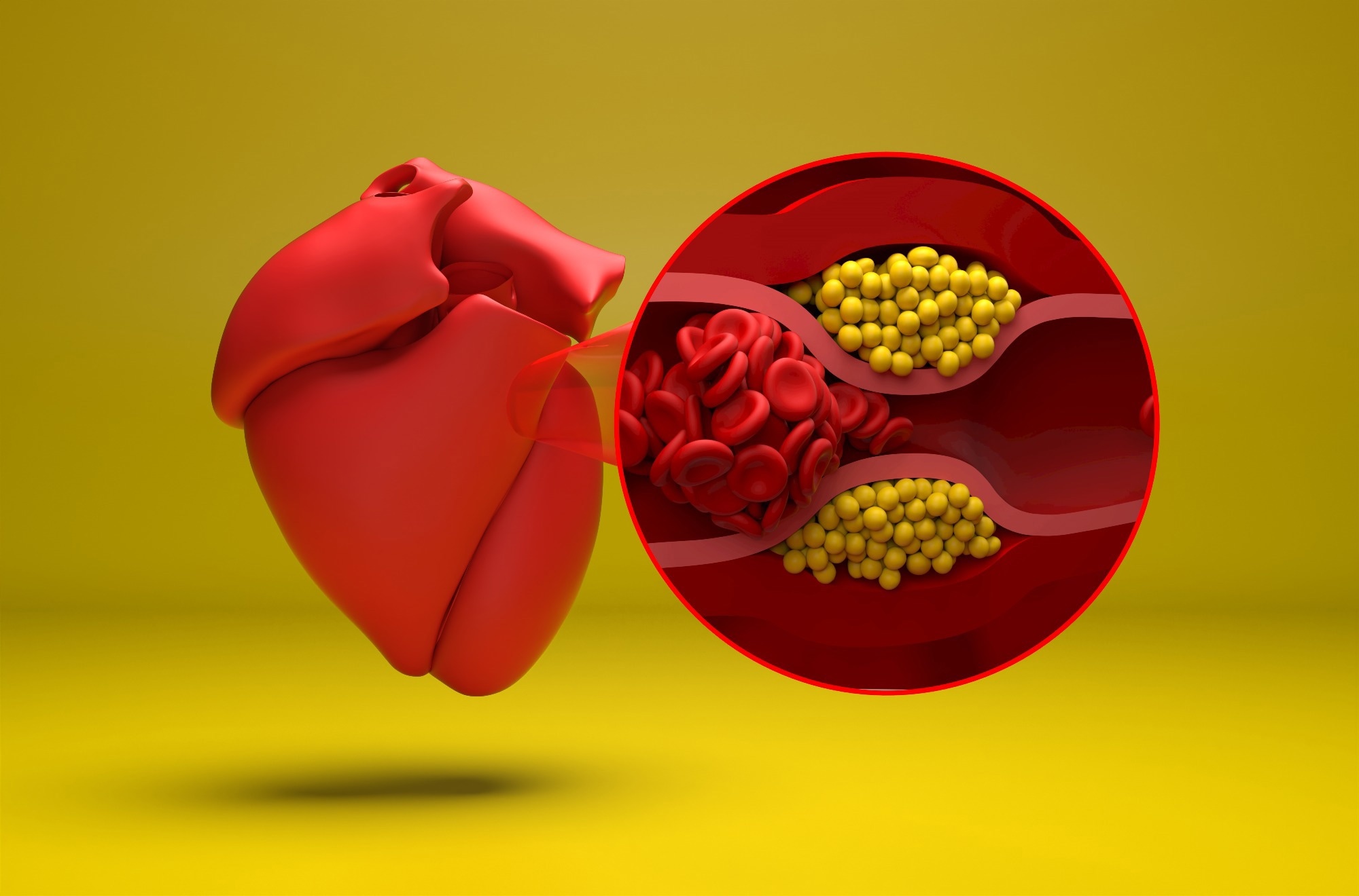 &Eacute;tude : Agonistes des r&eacute;cepteurs peptidiques 1 de type glucagon et &eacute;v&eacute;nements cardiovasculaires chez les adultes souffrant d'ob&eacute;sit&eacute; et de maladies auto-immunes&nbsp;: une &eacute;mulation d'essai cible. Cr&eacute;dit d'image : Nemes Laszlo/Shutterstock