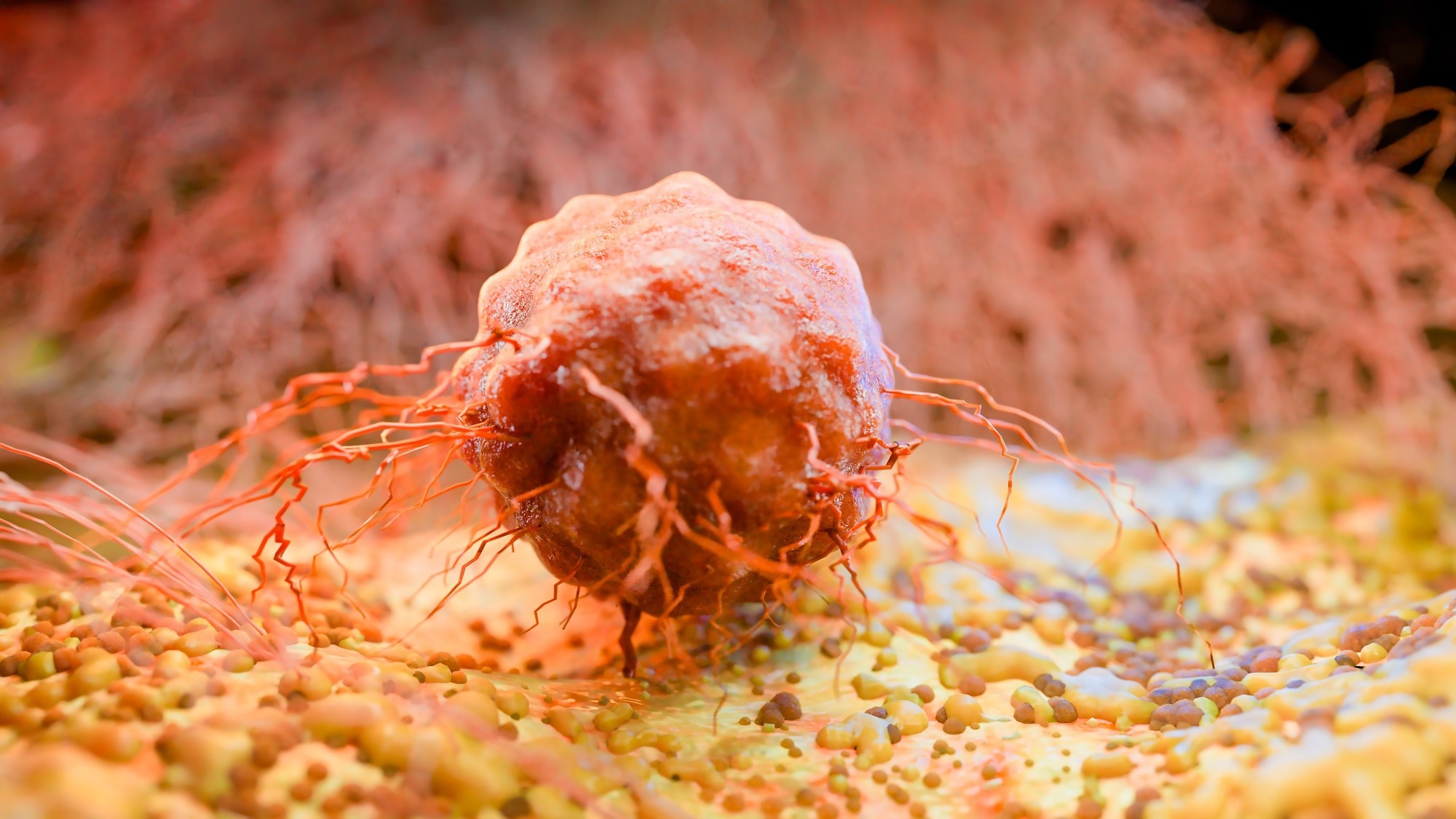 &Eacute;tude : Association entre les allergies et l&rsquo;incidence du cancer : une revue syst&eacute;matique et une m&eacute;ta-analyse. Cr&eacute;dit d'image : Belhadef.nabil/Shutterstock